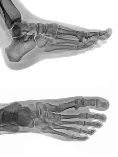 Detail of an x-ray of a foot