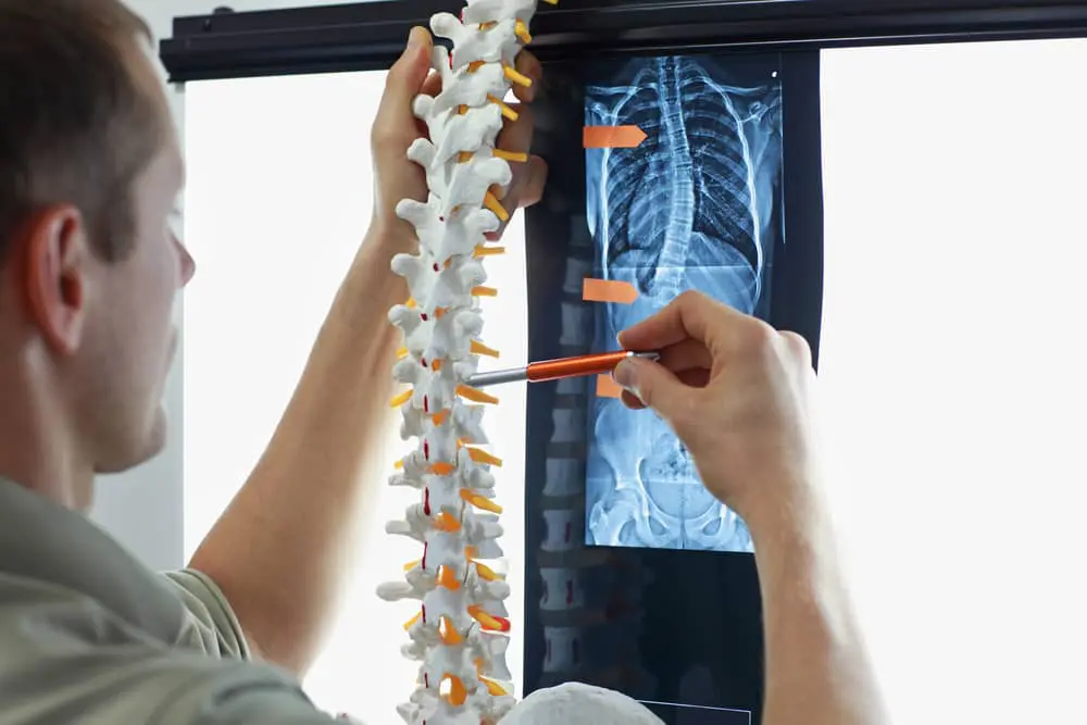 Doctor examining a spine model with a patient's x-ray result in front of him.