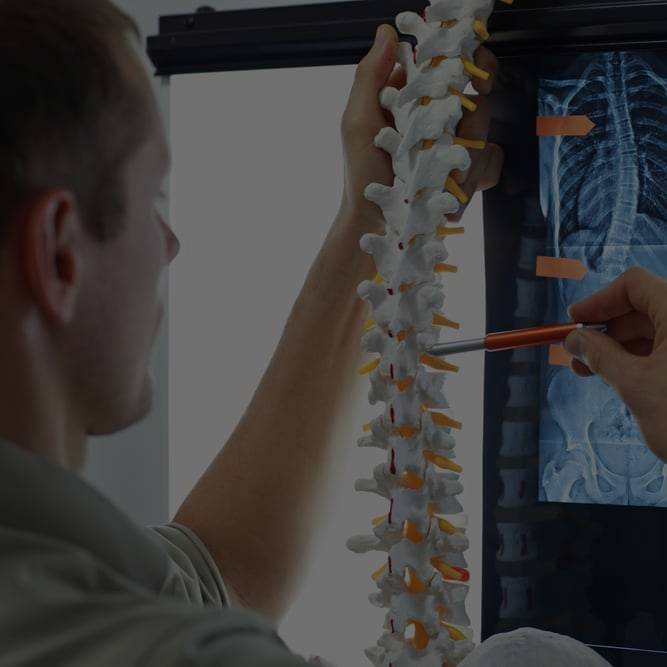 Doctor working with spine