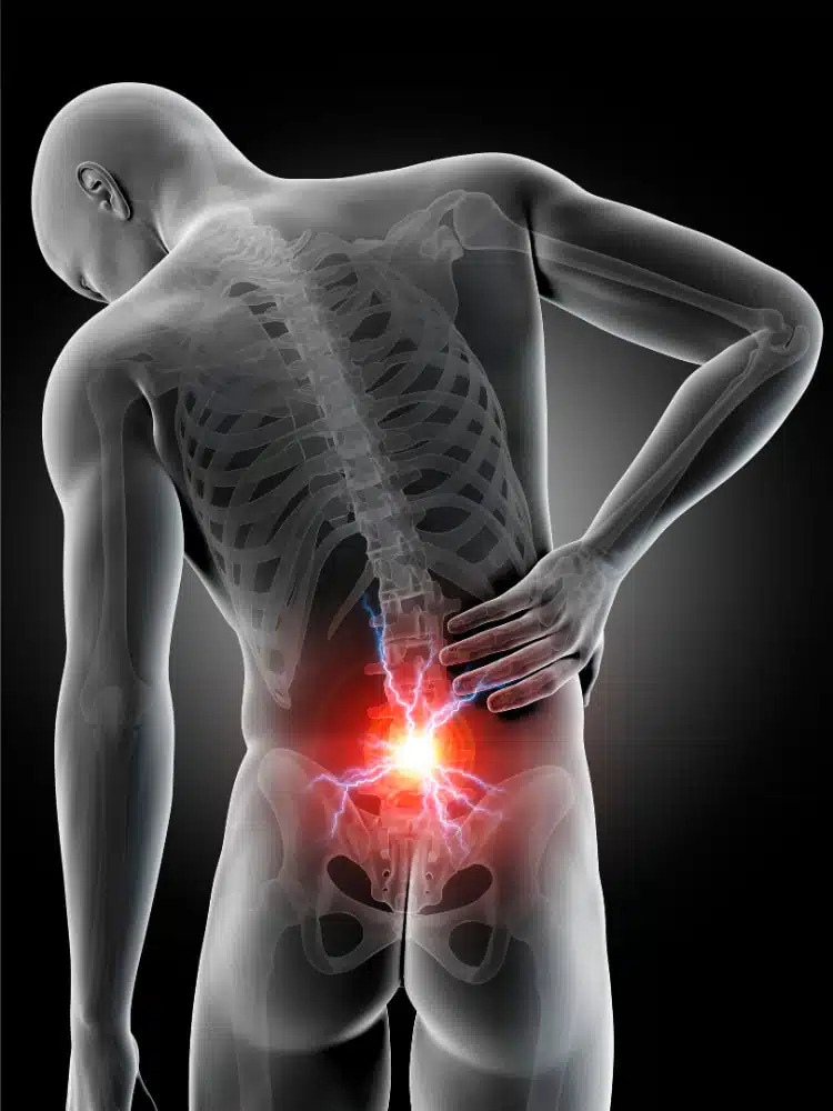 3D medical illustration of human skeletal with a back pain.