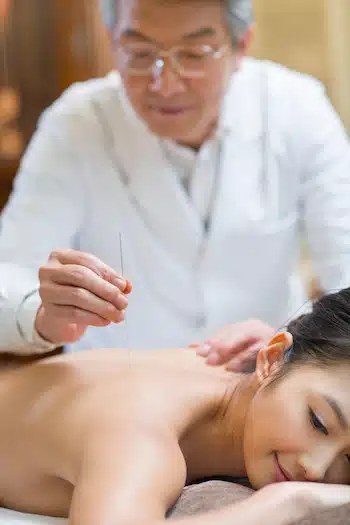 Acupuncture Treatment Process: acupuncturist applying the needle on woman's back